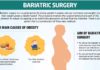Bariatric Surgery in Bandra