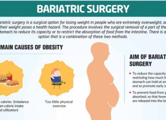 Bariatric Surgery in Bandra